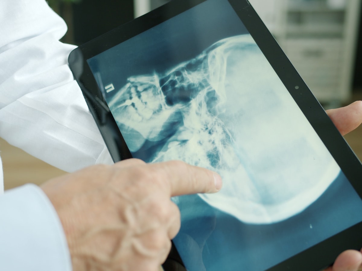 Doctor reviewing imaging results on a tablet